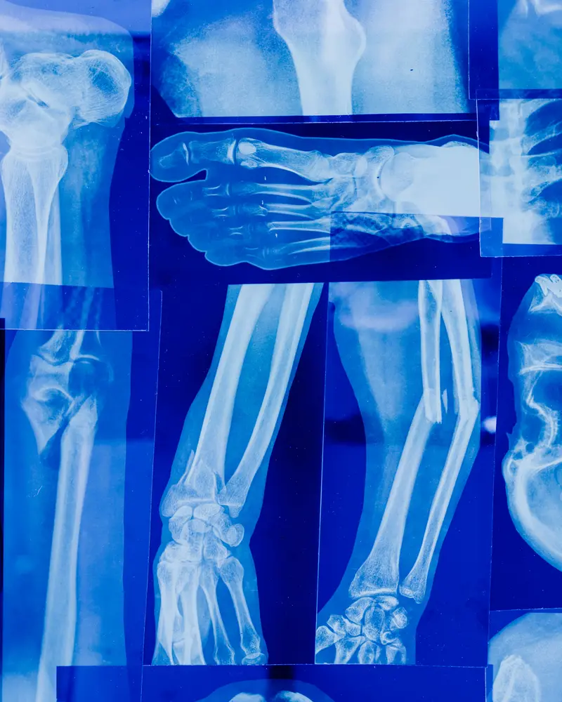 Medical X-rays representing evidence in a clinical negligence complaint in the UK